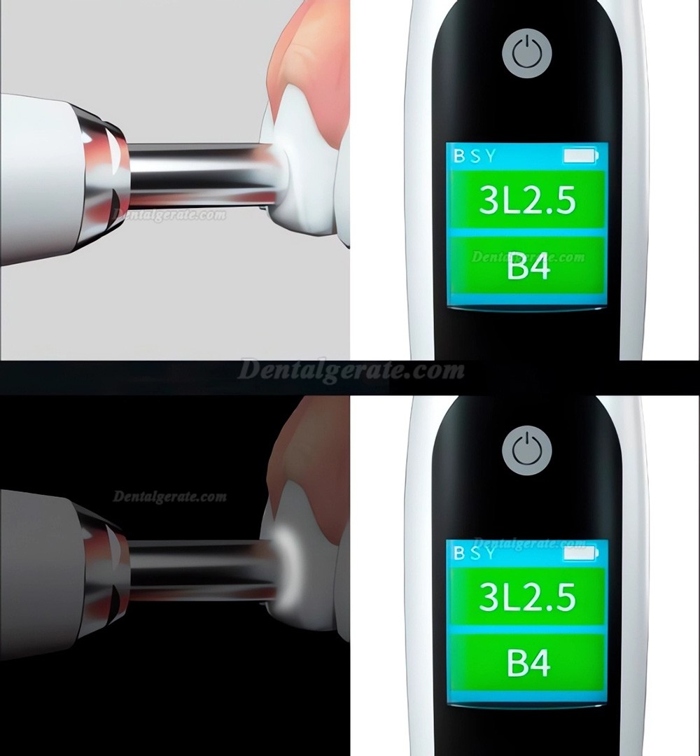 Koungsun E220 Digitaler Zahnfarbvergleichsger&auml;t f&uuml;r Zahn&auml;rzte Kompatibel mit PS VITA Classical / 3D-Master